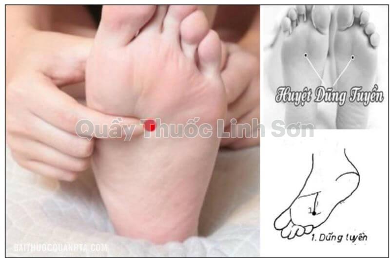 Bấm huyệt dũng tuyền để ngủ